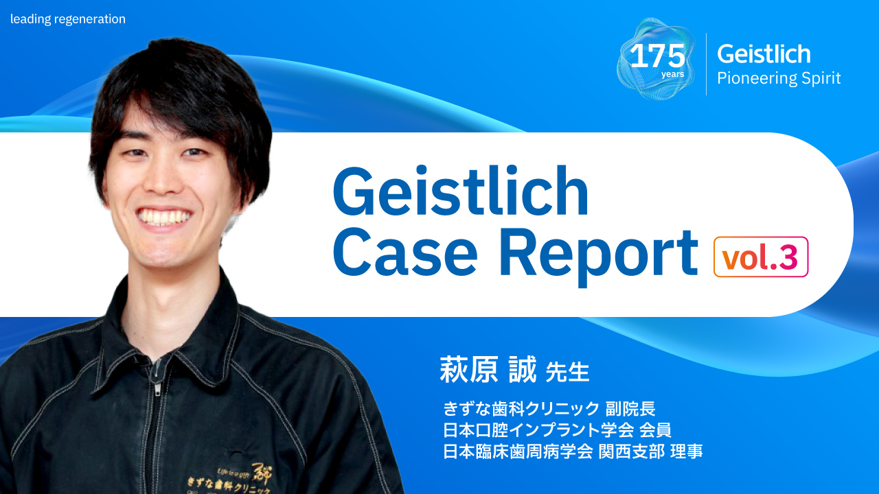 Case Report】Bio-Oss® を活用したインプラント治療4症例 ―GBR・即時埋