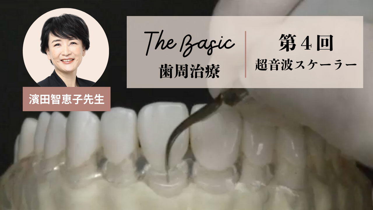 濱田智恵子先生のThe Basic 歯周治療 第4回 超音波スケーラーの