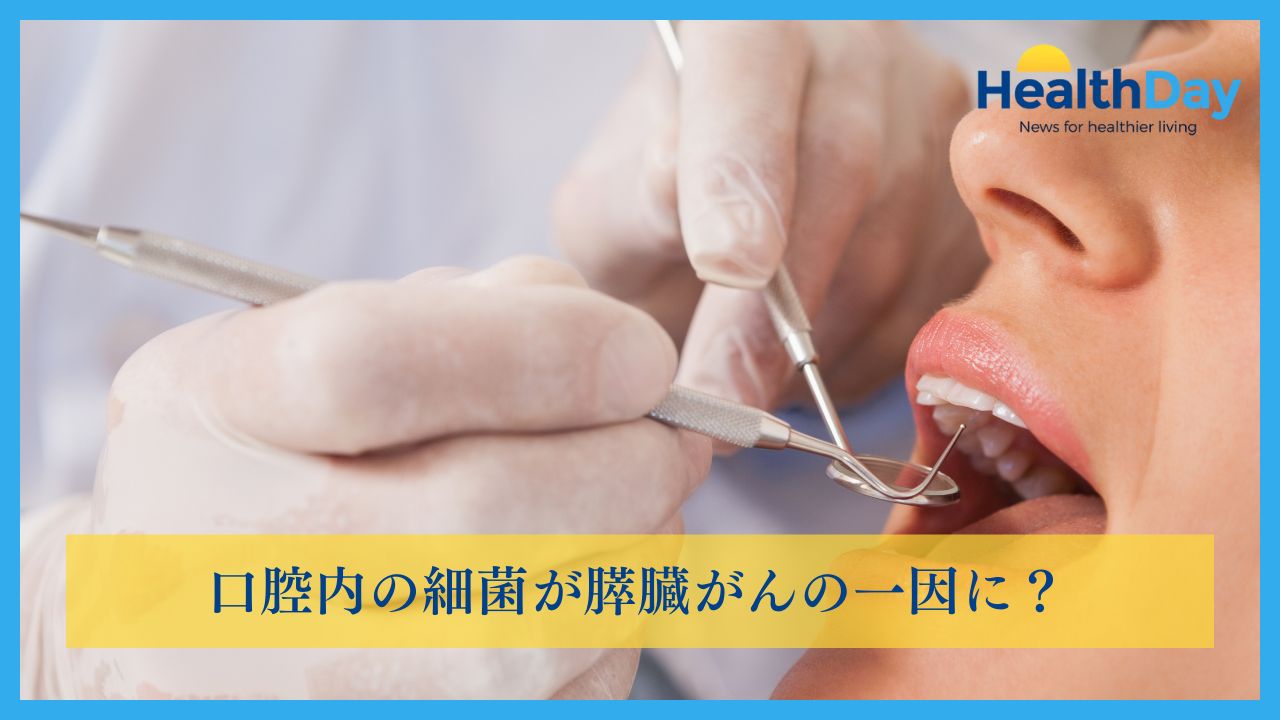 口腔内の細菌が膵臓がんの一因に？の画像です。