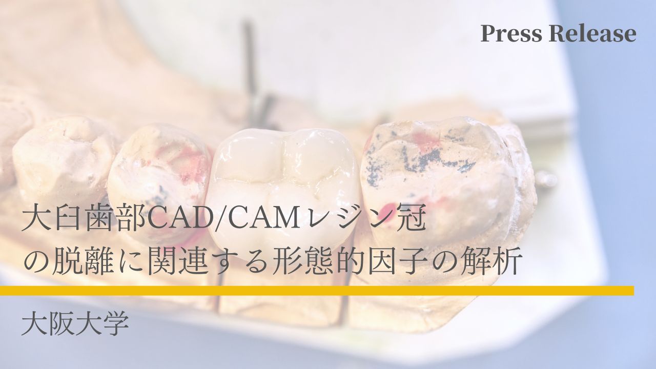 大臼歯部CAD/CAMレジン冠の脱離に関連する形態的因子の解析 大阪大学