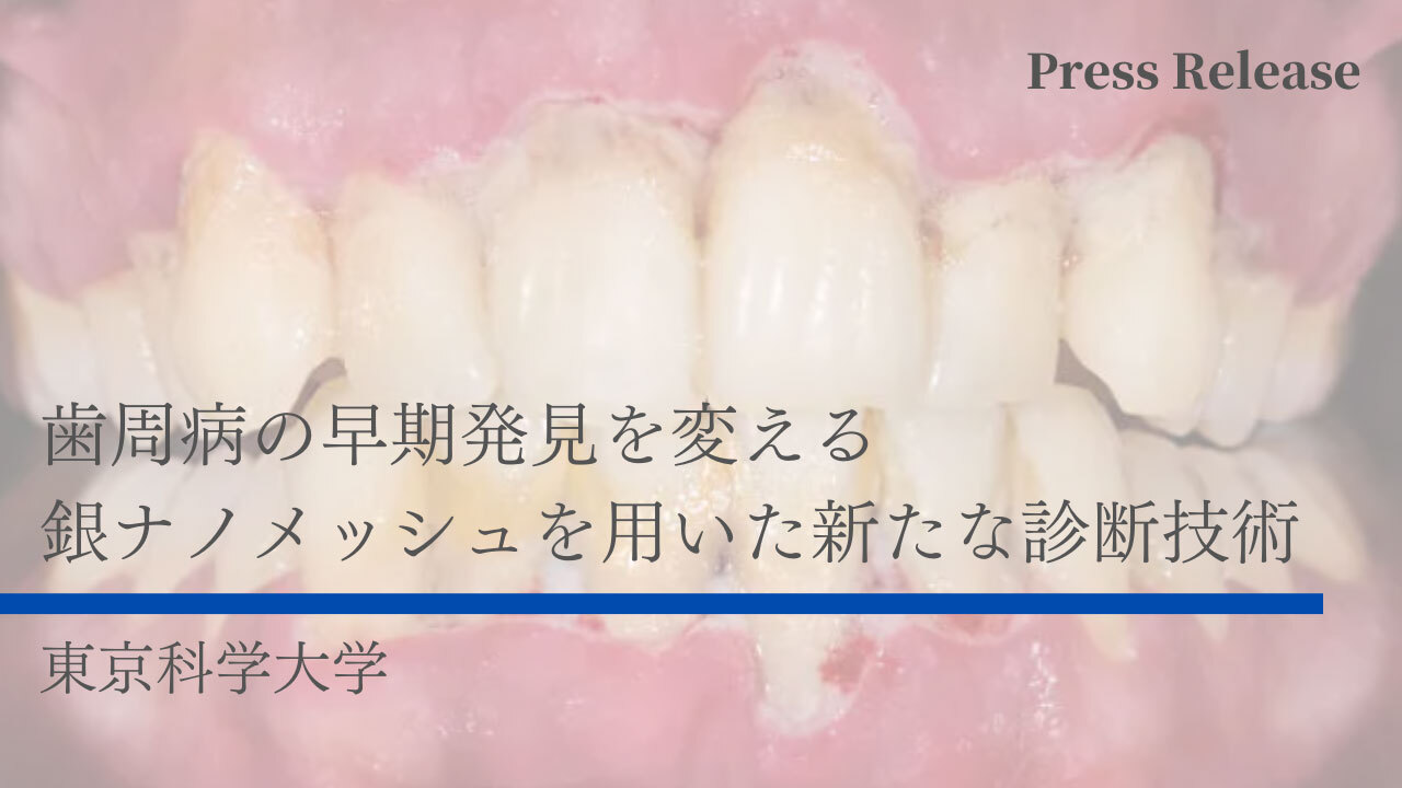 歯周病の早期発見を変える銀ナノメッシュを用いた新たな診断技術　東京科学大学の画像です。