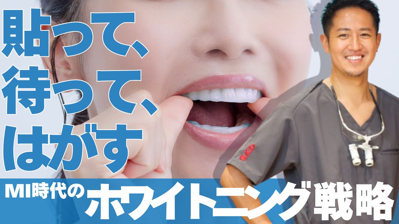 ホワイトニング×MIがもたらす新たな審美治療の選択肢 ～症例から読み解く、製品の有用性～の画像です。