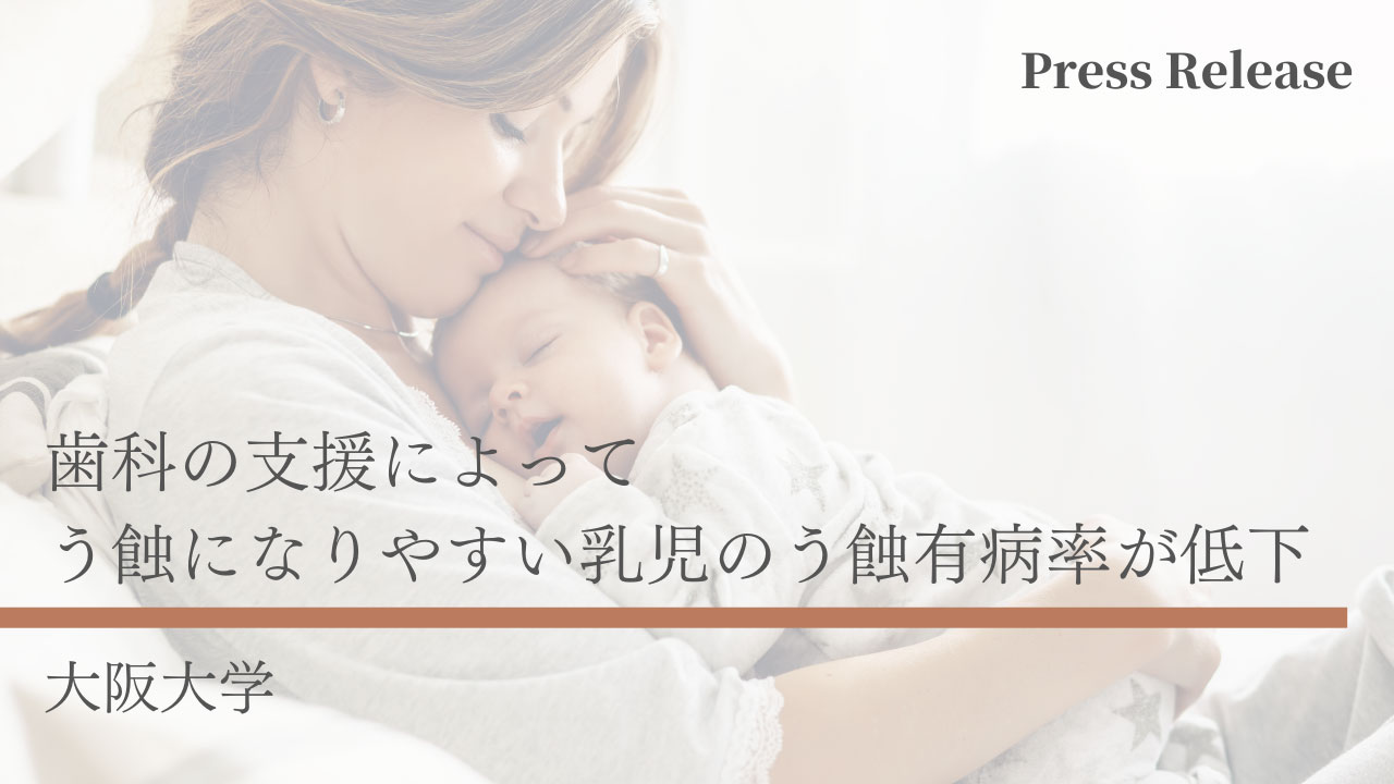 歯科の支援によって、う蝕になりやすい乳児のう蝕有病率が低下する可能性　大阪大学の画像です。