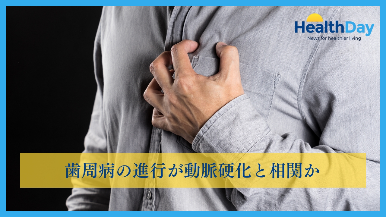 歯周病の進行が動脈硬化と相関かの画像です。