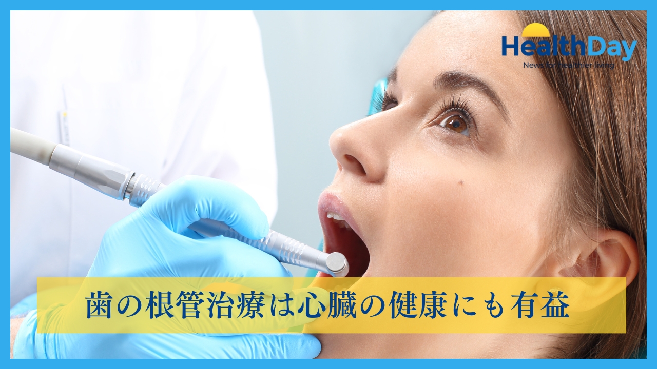 歯の根管治療は心臓の健康にも有益の画像です。