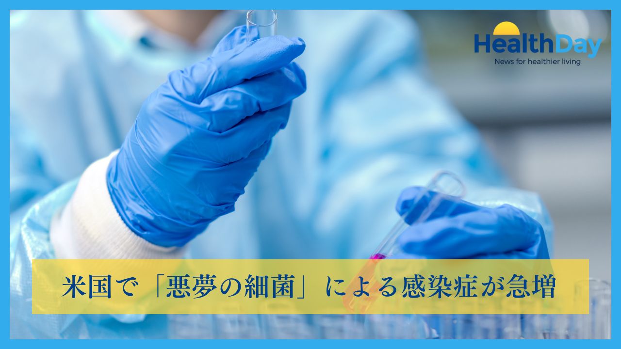 米国で「悪夢の細菌」による感染症が急増の画像です。