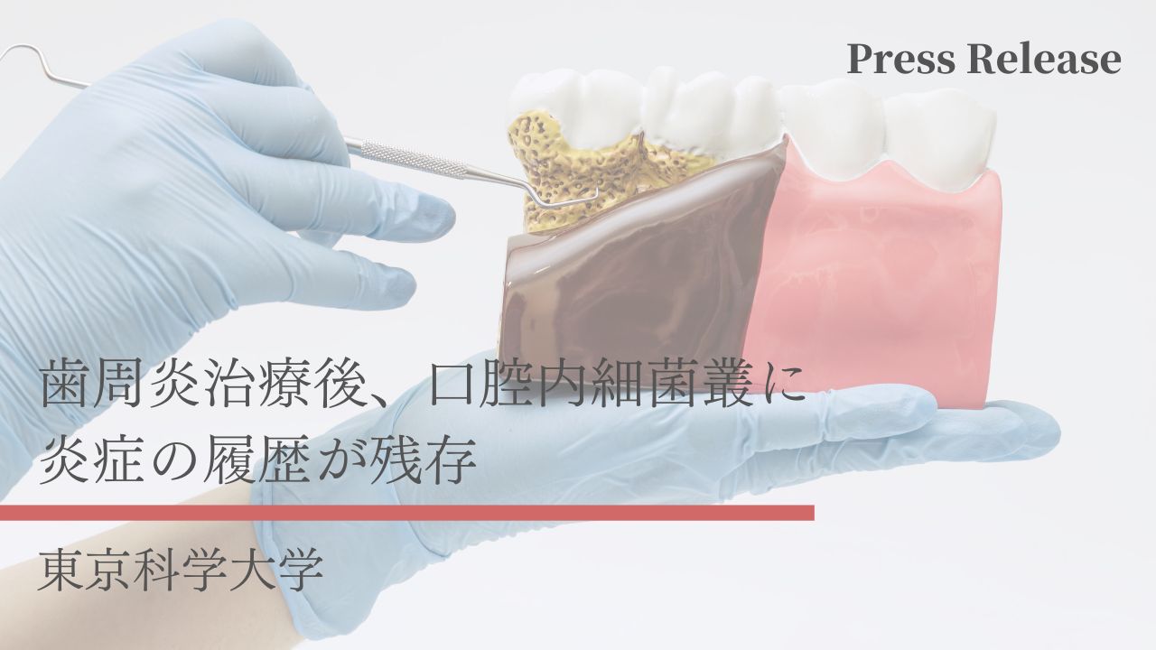 歯周炎治療後、口腔内細菌叢に炎症の履歴が残存 東京科学大学