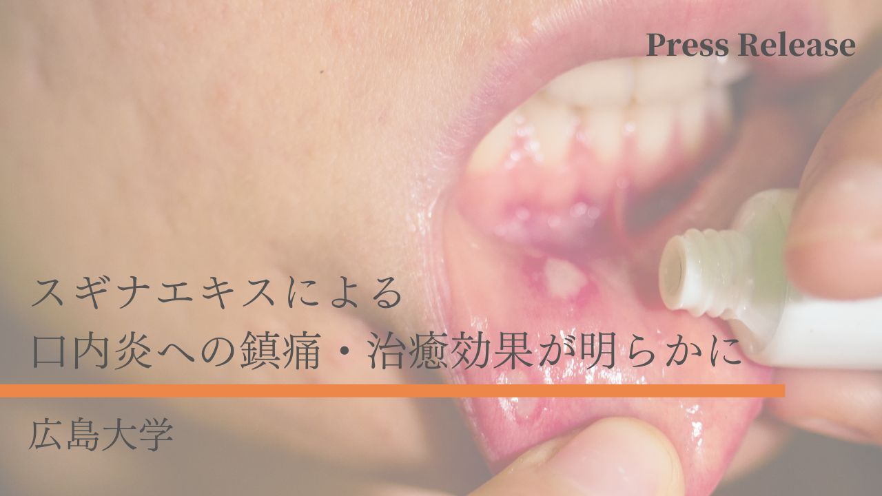 スギナエキスによる口内炎への鎮痛・治癒効果が明らかに　広島大学の画像です。