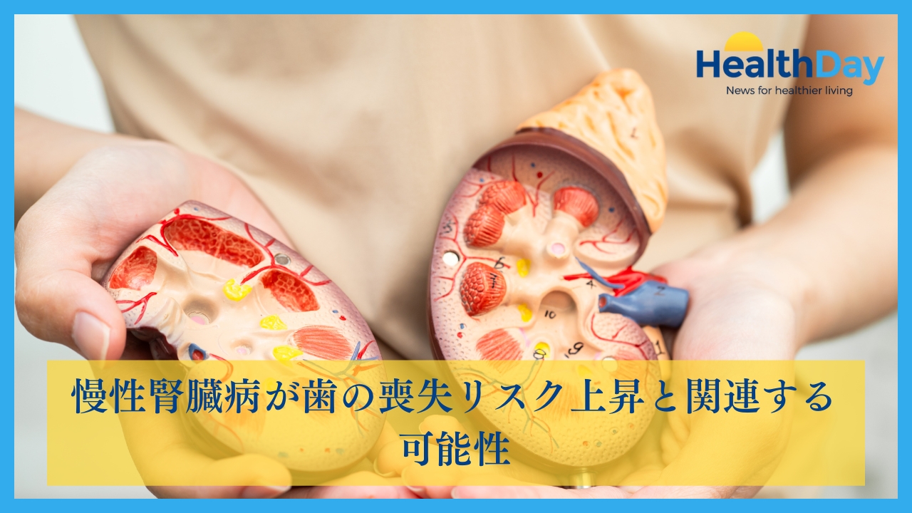 慢性腎臓病が歯の喪失リスク上昇と関連する可能性の画像です。