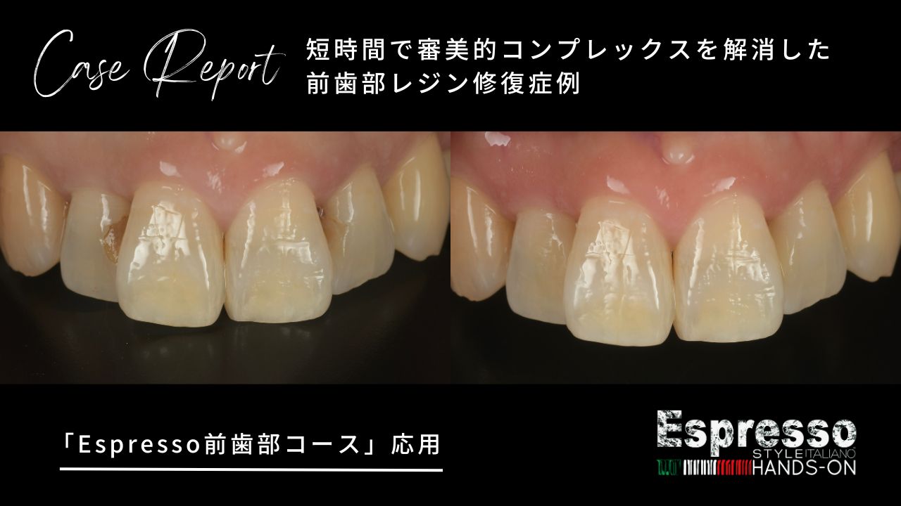 Case report】短時間で審美的コンプレックスを解消した前歯部