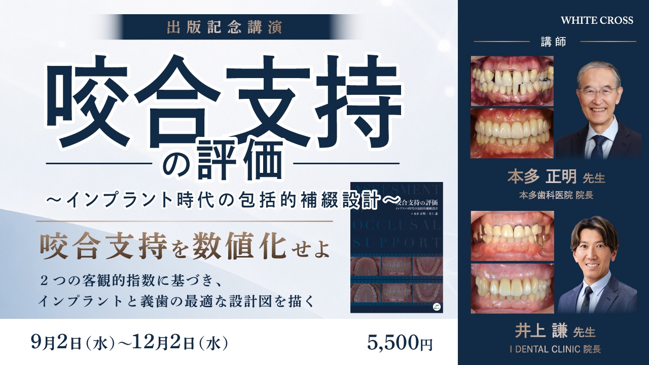 咬合支持の評価〜インプラント時代の包括的補綴設計〜 | WHITE CROSS
