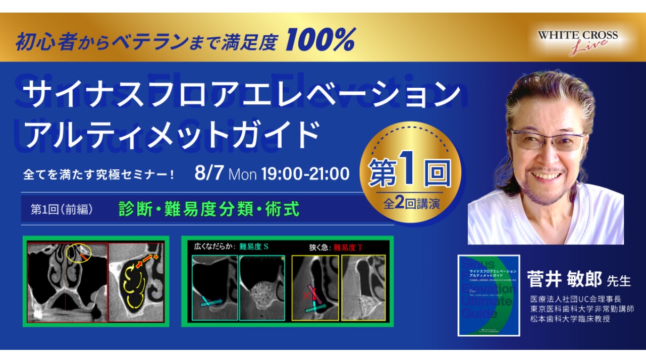 録画配信］サイナスフロアエレベーション アルティメットガイド 全てを