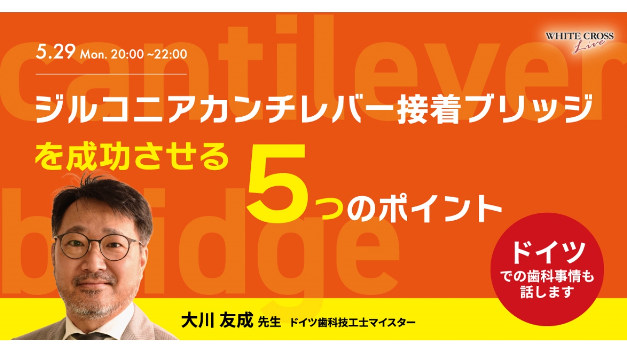 録画配信］ジルコニアカンチレバー接着ブリッジを成功させる「5つ」の
