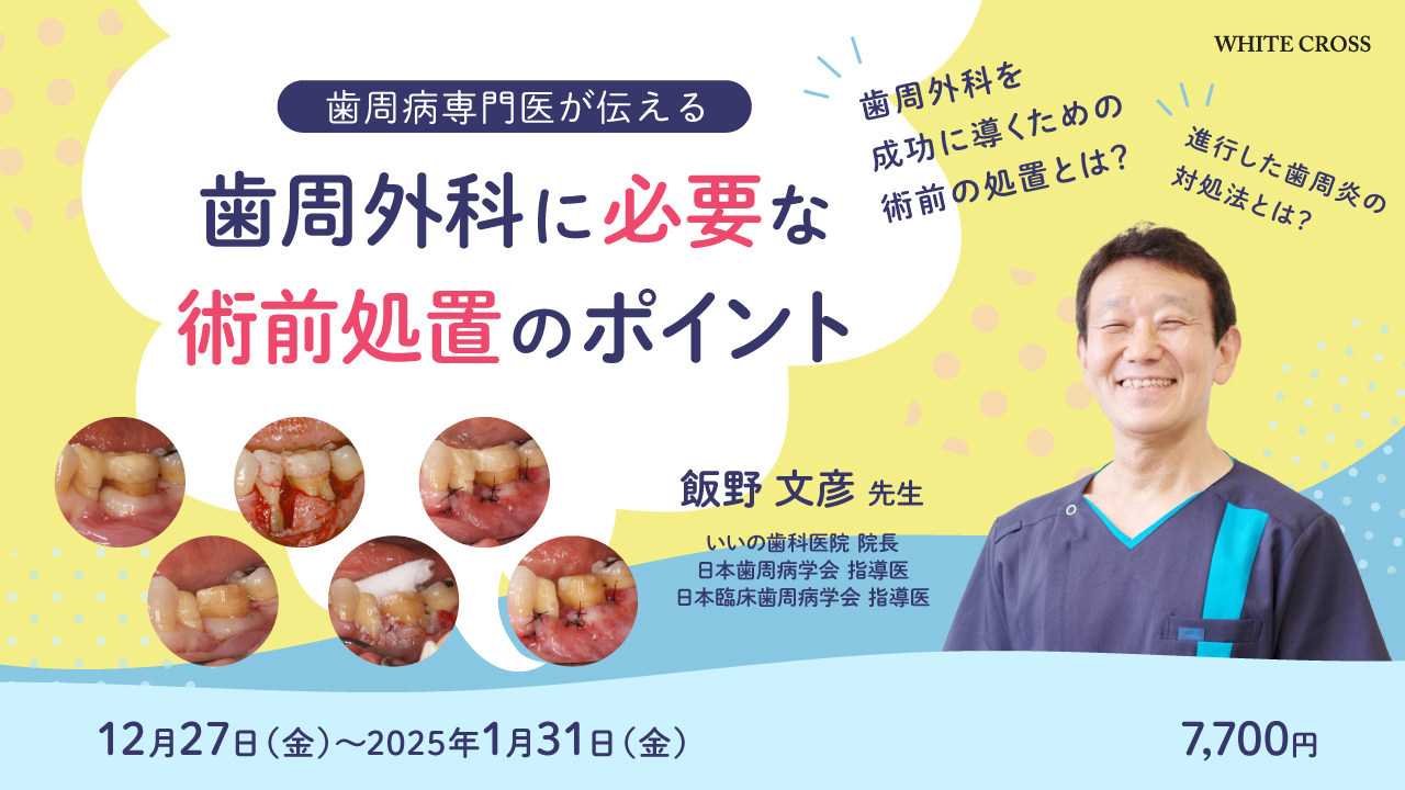 歯周外科 見て学んで始めるガイド 歯周基本治療から手技習得のポイント，術後のケア 歯周外科 見て学んで始めるガイド - クインテッセンス出版