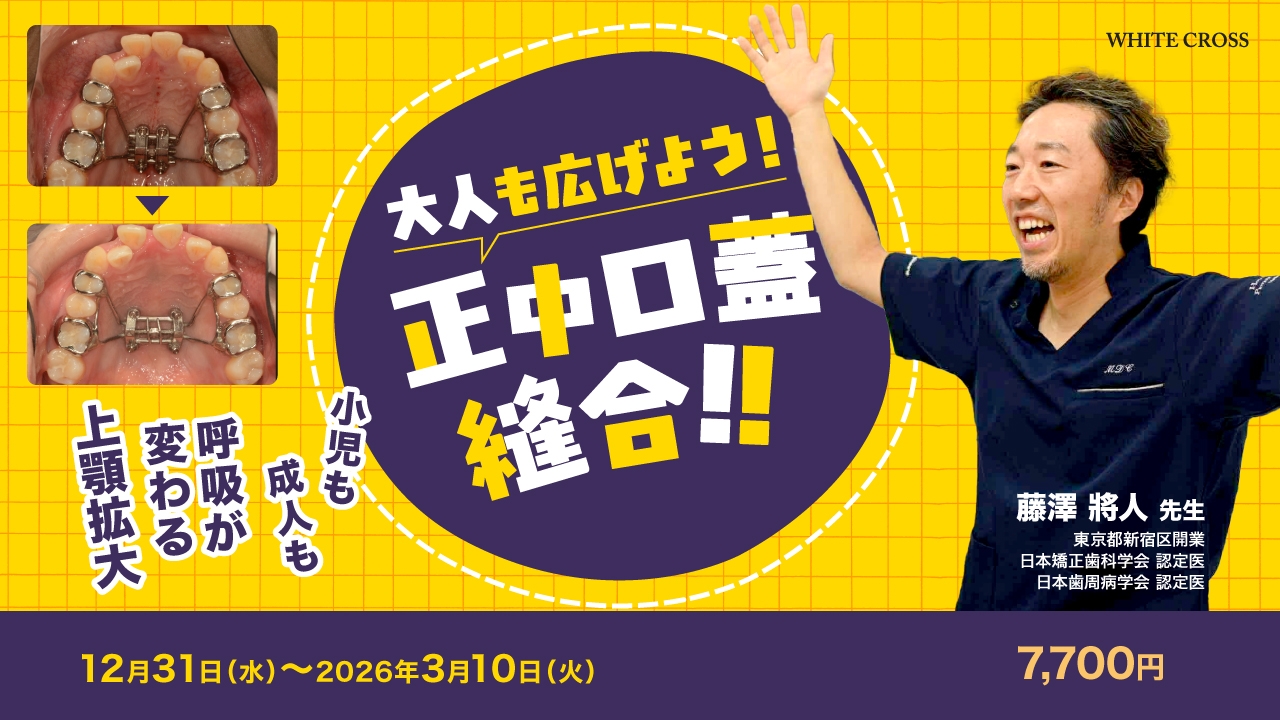 大人も広げよう！正中口蓋縫合！！ | WHITE CROSS