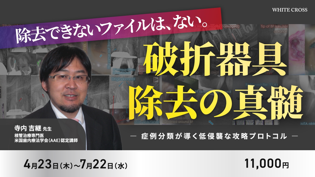 破折器具除去の真髄〜症例分類が導く低侵襲な攻略プロトコル〜 | WHITE