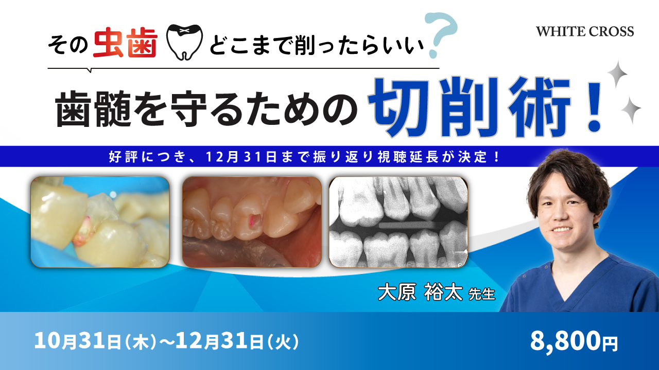 ⚠裁断済　歯周外科を始めるために知っておきたい10のこと 歯周病検査の重要性と進行予防について | TikTok
