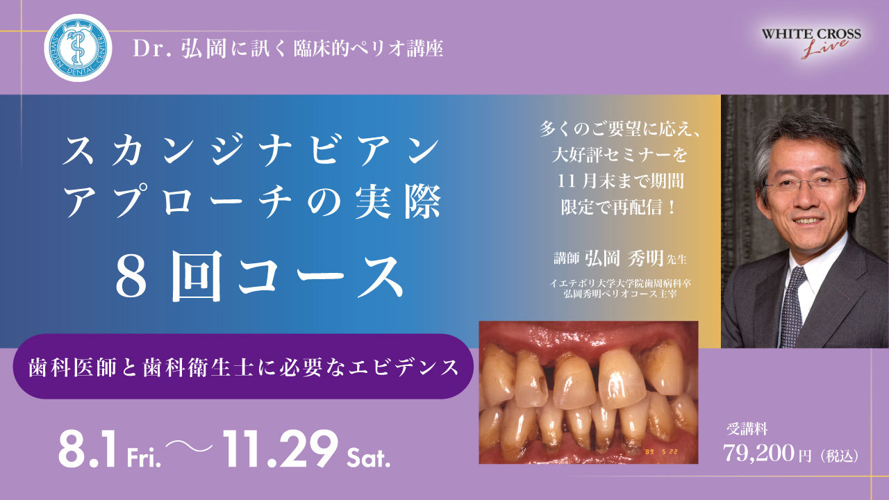 Dr弘岡に訊く臨床的ペリオ講座スカンジナビアンアプローチの実践　裁断済み Dr.弘岡に訊く臨床的ペリオ講座 スカンジナビアンアプローチの