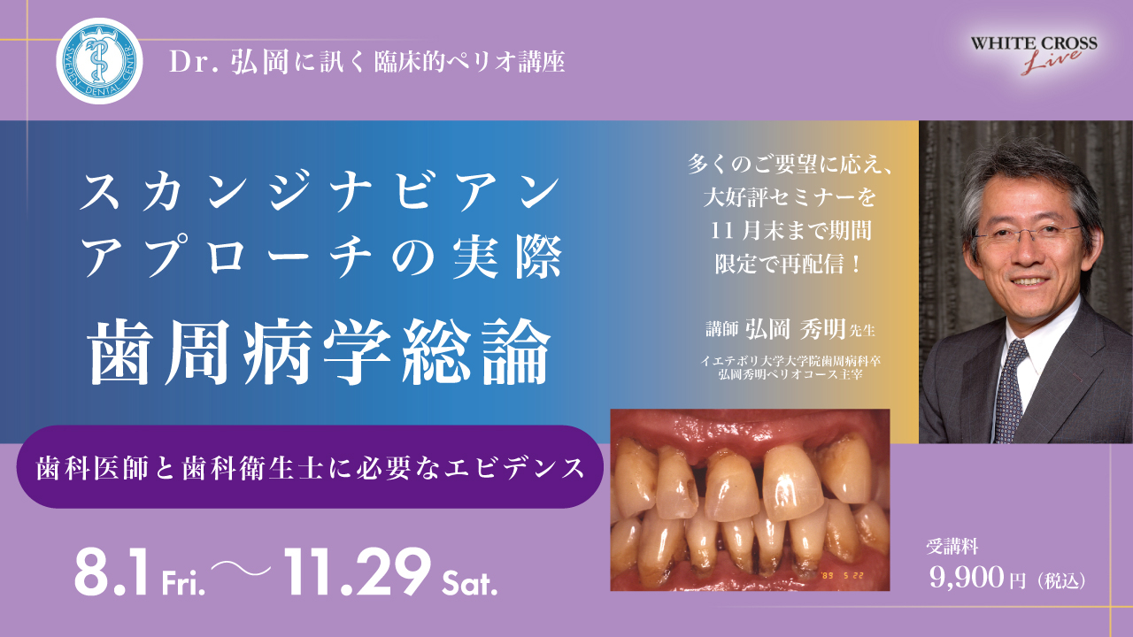 Dr.弘岡に訊く臨床的ペリオ講座 スカンジナビアンアプローチの