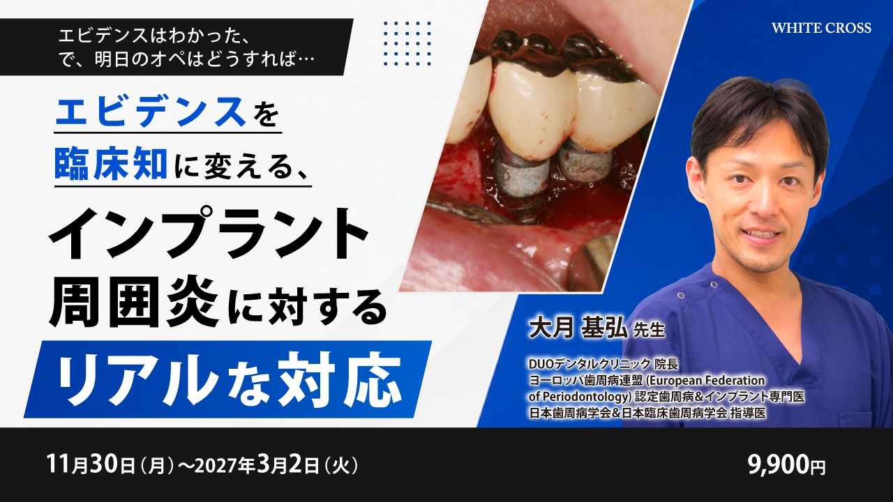 エビデンスを臨床知に変える、インプラント周囲炎に対するリアルな対応