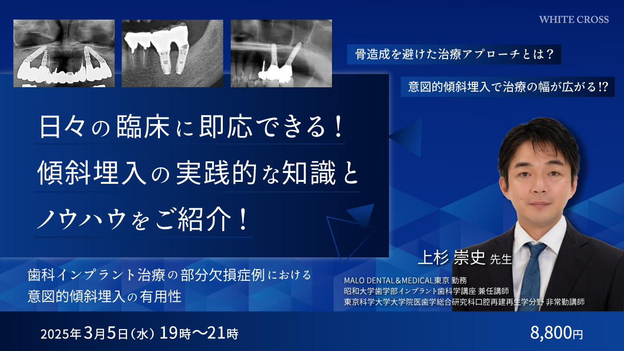 誰もが遭遇するインプラント補綴の合併症 誰もが遭遇するインプラント 