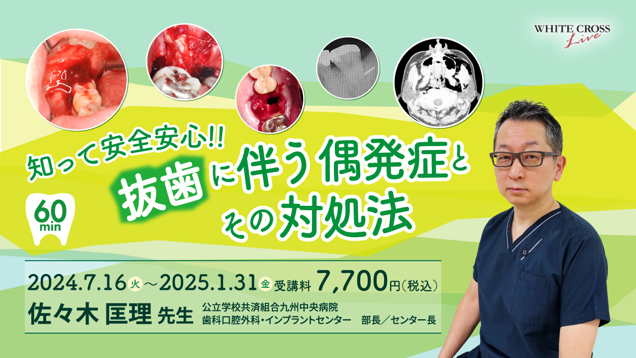 VOD］知って安全安心！！抜歯に伴う偶発症とその対処法 | WHITE