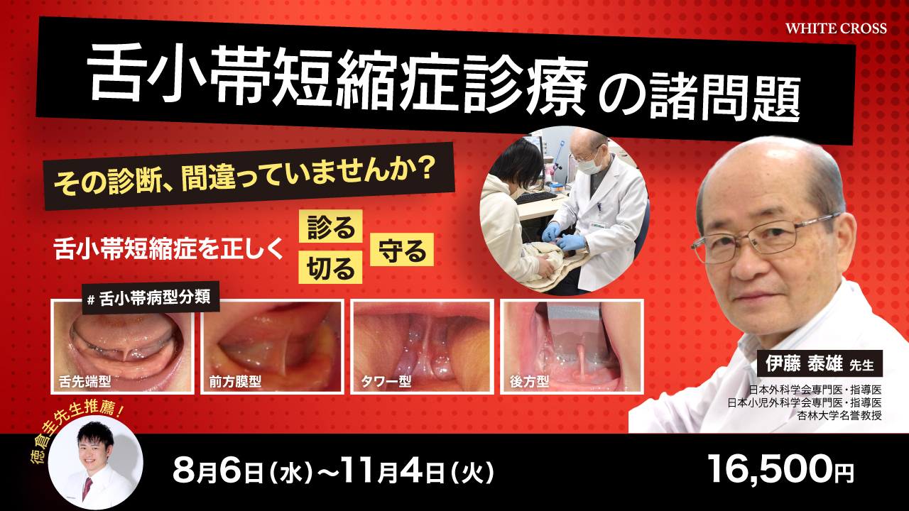 触診可動検査・ソフト徒手矯正法 舌小帯短縮症診療の諸問題 | WHITE CROSS