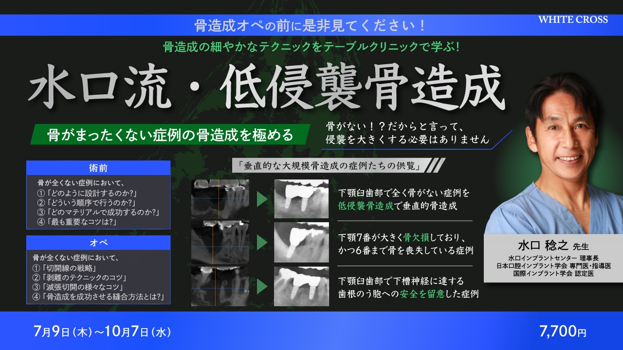 水口流・低侵襲骨造成〜骨がまったくない症例の骨造成を極める
