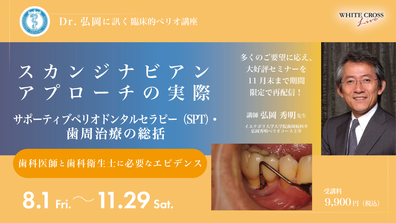 【裁断済】Dr.弘岡に訊く臨床的ペリオ講座 スカンジナビアンアプローチの実践 Dr.弘岡に訊く臨床的ペリオ講座 スカンジナビアンアプローチの