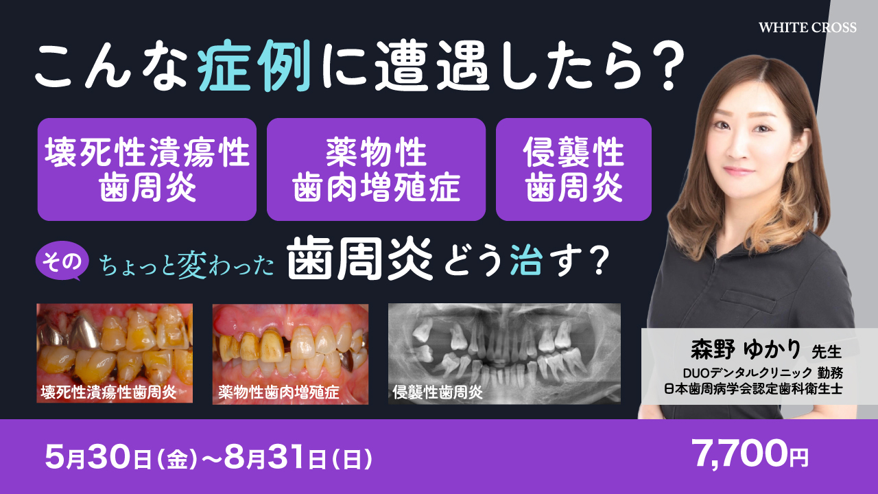 裁断済み　ペリオの臨床戦略を学ぶ歯周動的治療 ペリオの臨床戦略を学ぶ歯周動的治療 - クインテッセンス出版