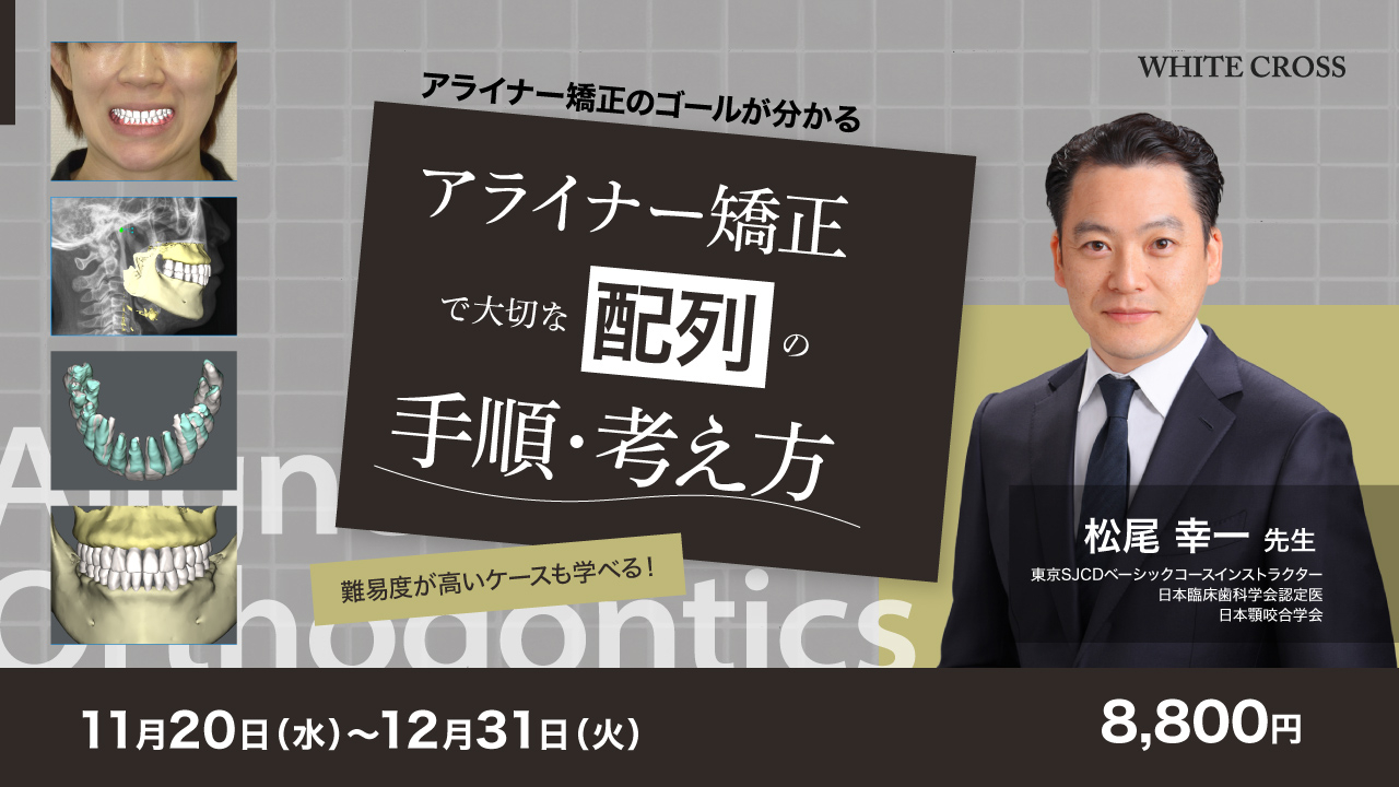 アライナー矯正で大切な配列の手順・考え方 | WHITE CROSS