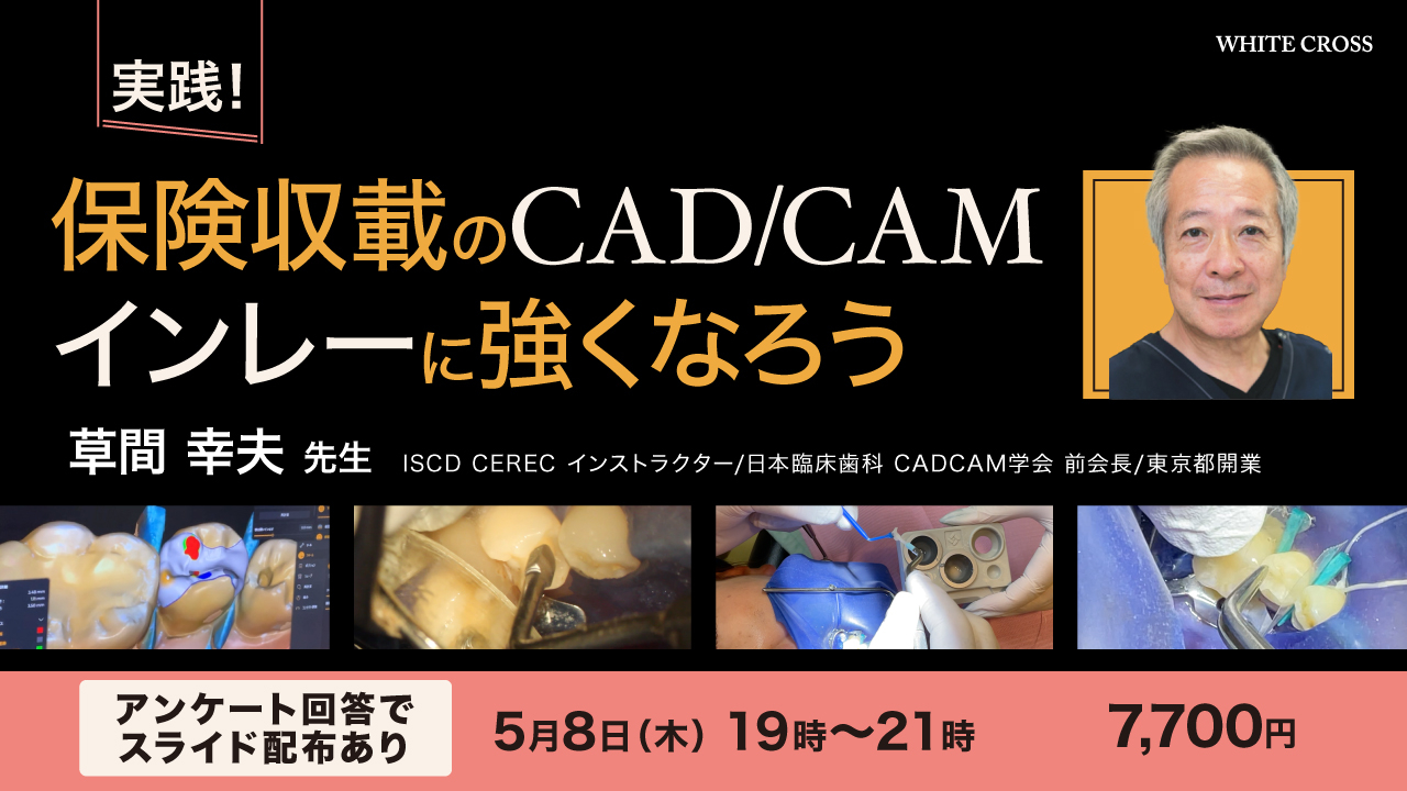 Amazon.co.jp: 保険改定対応 CAD/CAM修復物入門: CAD/CAM冠、CAD