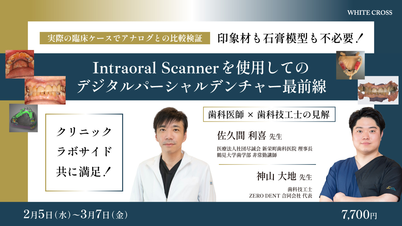 印象材も石膏模型も不必要！Intraoral Scannerを使用してのデジタル