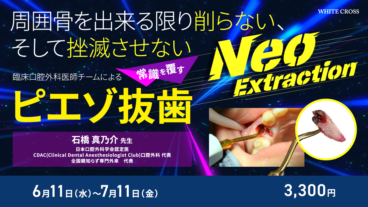 Neo Extraction 臨床口腔外科医師チームによる常識を覆すピエゾ抜歯