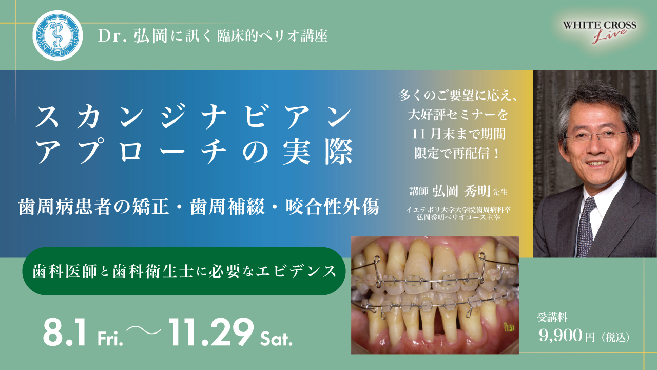 【裁断済】Dr.弘岡に訊く臨床的ペリオ講座 スカンジナビアンアプローチの実践 裁断済】Dr.弘岡に訊く臨床的ペリオ講座 スカンジナビアン