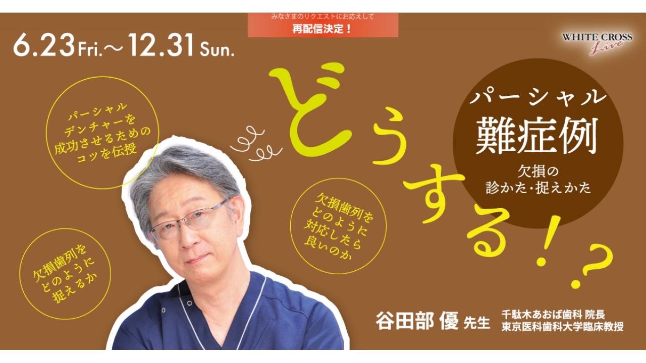 パーシャルデンチャーを得意になろう! 設計原則からトラブル対応までの臨床ガイド Amazon.co.jp: パーシャルデンチャーを得意になろう! : 五十嵐