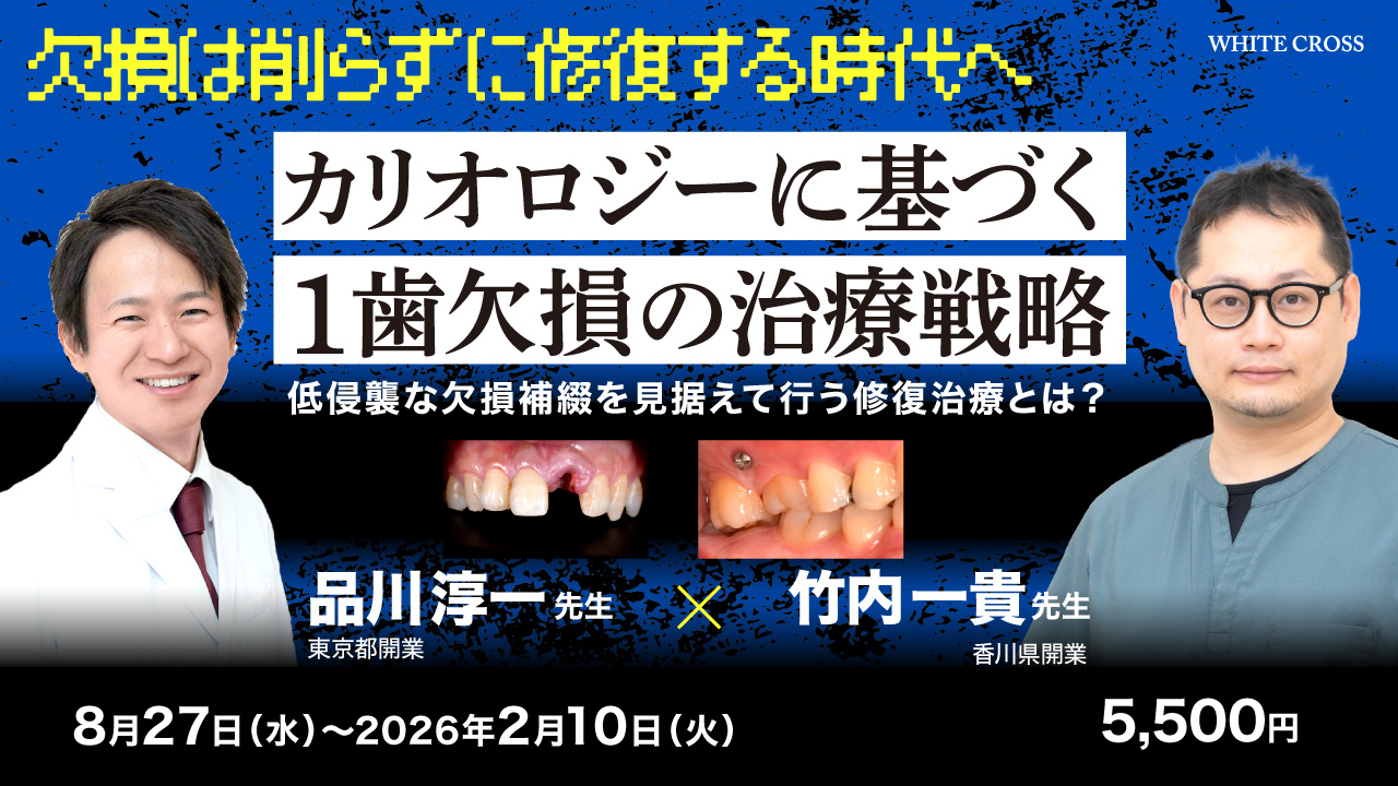 カリオロジーに基づく1歯欠損の治療戦略 | WHITE CROSS