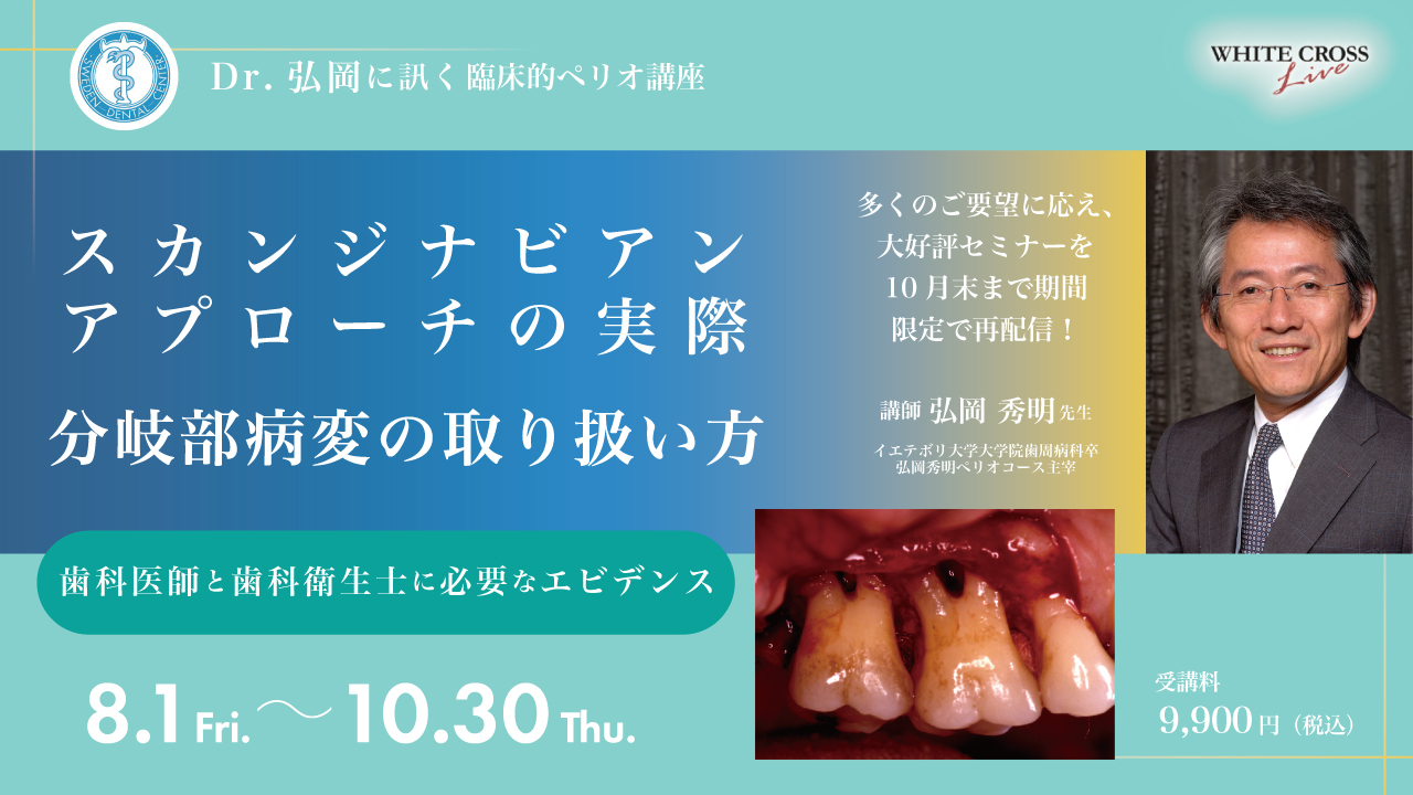 Dr.弘岡に訊く臨床的ペリオ講座 スカンジナビアンアプローチの