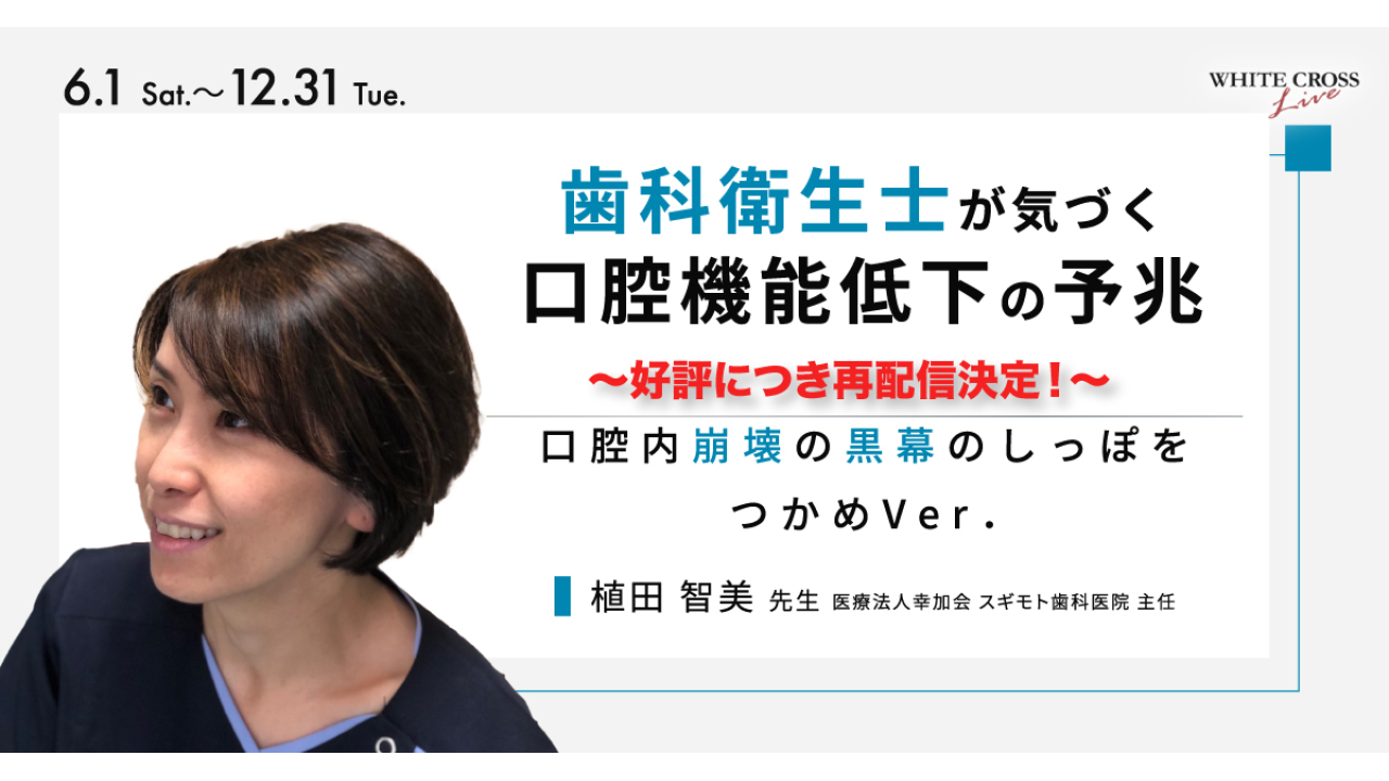 【1年保証&サポート付】歯科医師 歯科衛生士 口腔内撮影 軽量 デジタル カメラ 歯科用口腔撮影デジタルカメラ カメラ