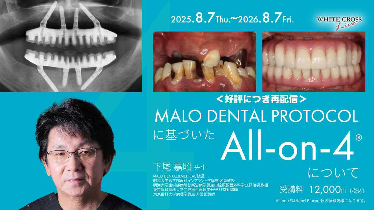 健康・医学 MAXILLA-ORIENTED IMPLANTOLOGY MALO DENTAL PROTOCOLに基づいた正しいAll-on-4®️について【再配信