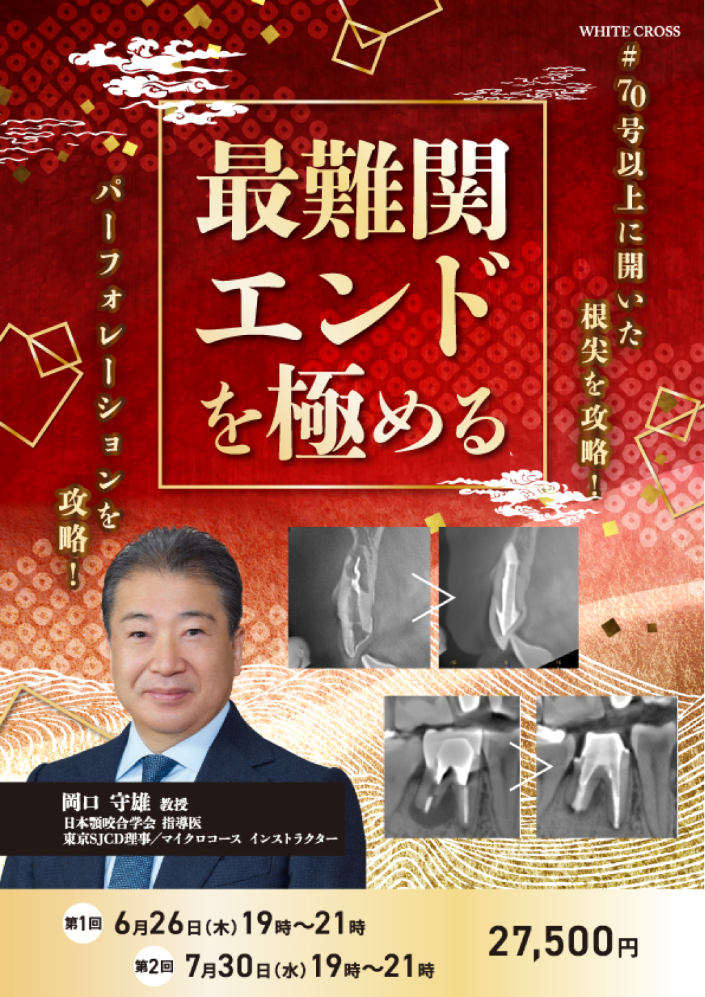 ［録画配信］最難関エンドを極めるの画像です。