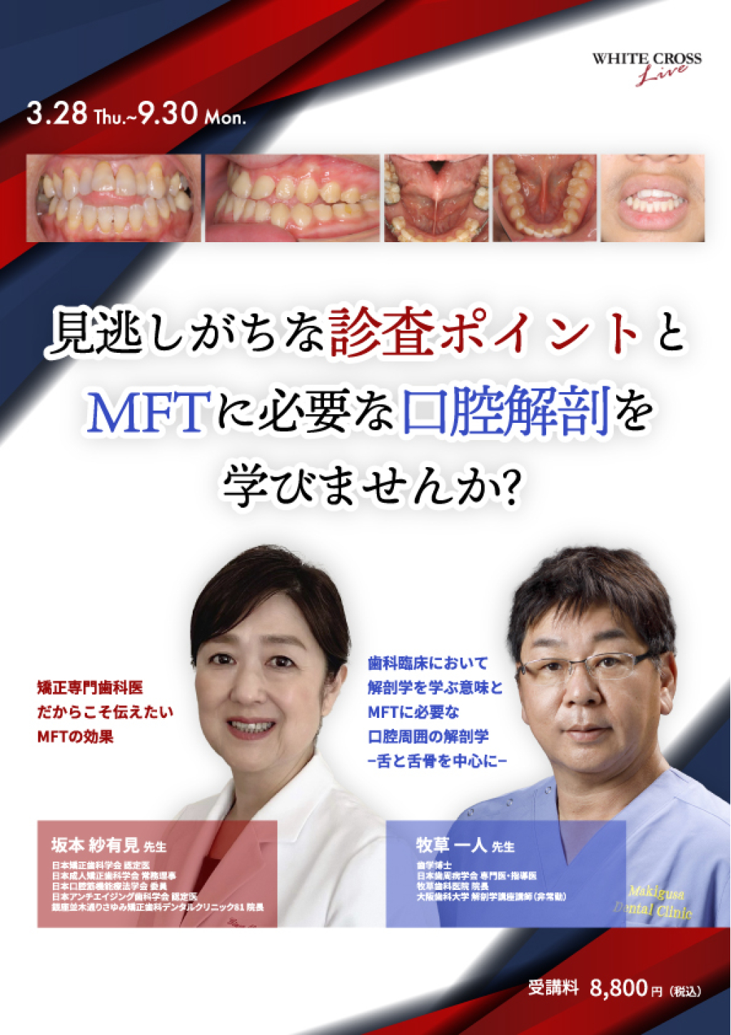 VOD］見逃しがちな診査ポイントとMFTに必要な口腔解剖を学