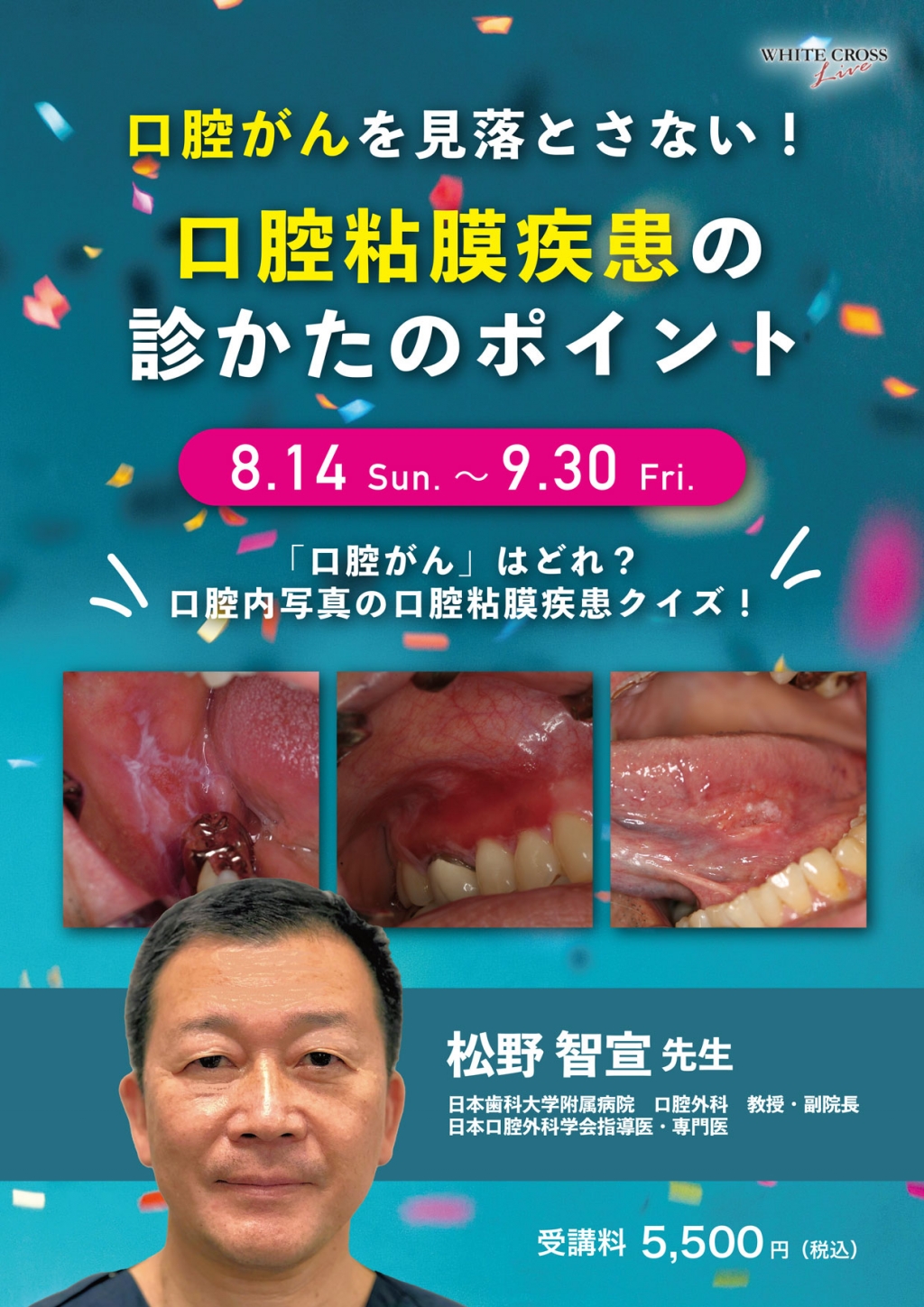 歯科クリニックで見逃してはいけない 口腔粘膜疾患 書評】歯科クリニックで見逃してはいけない 口腔粘膜疾患―経過