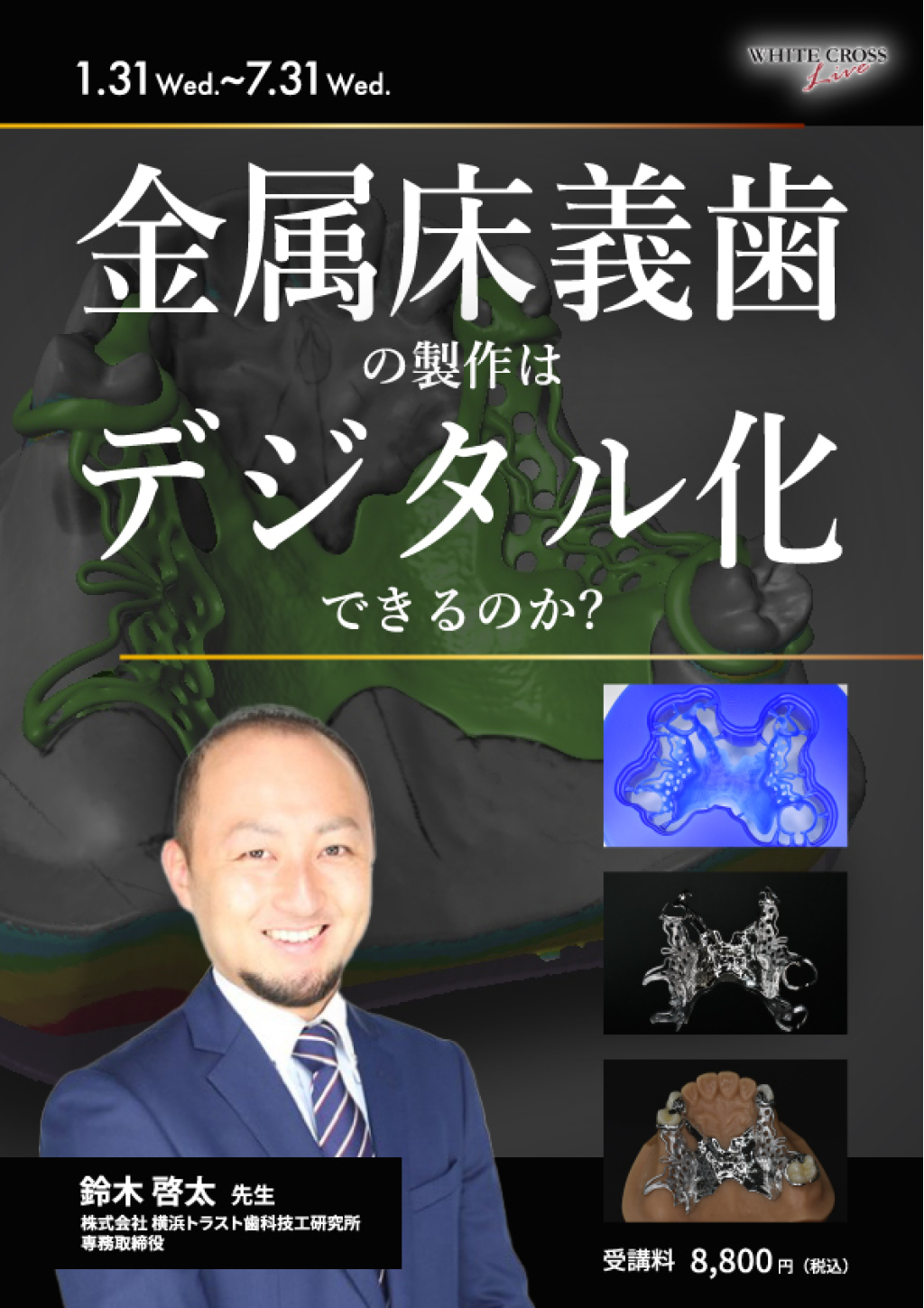 VOD］金属床義歯の製作はデジタル化できるのか？ | WHITE CROSS