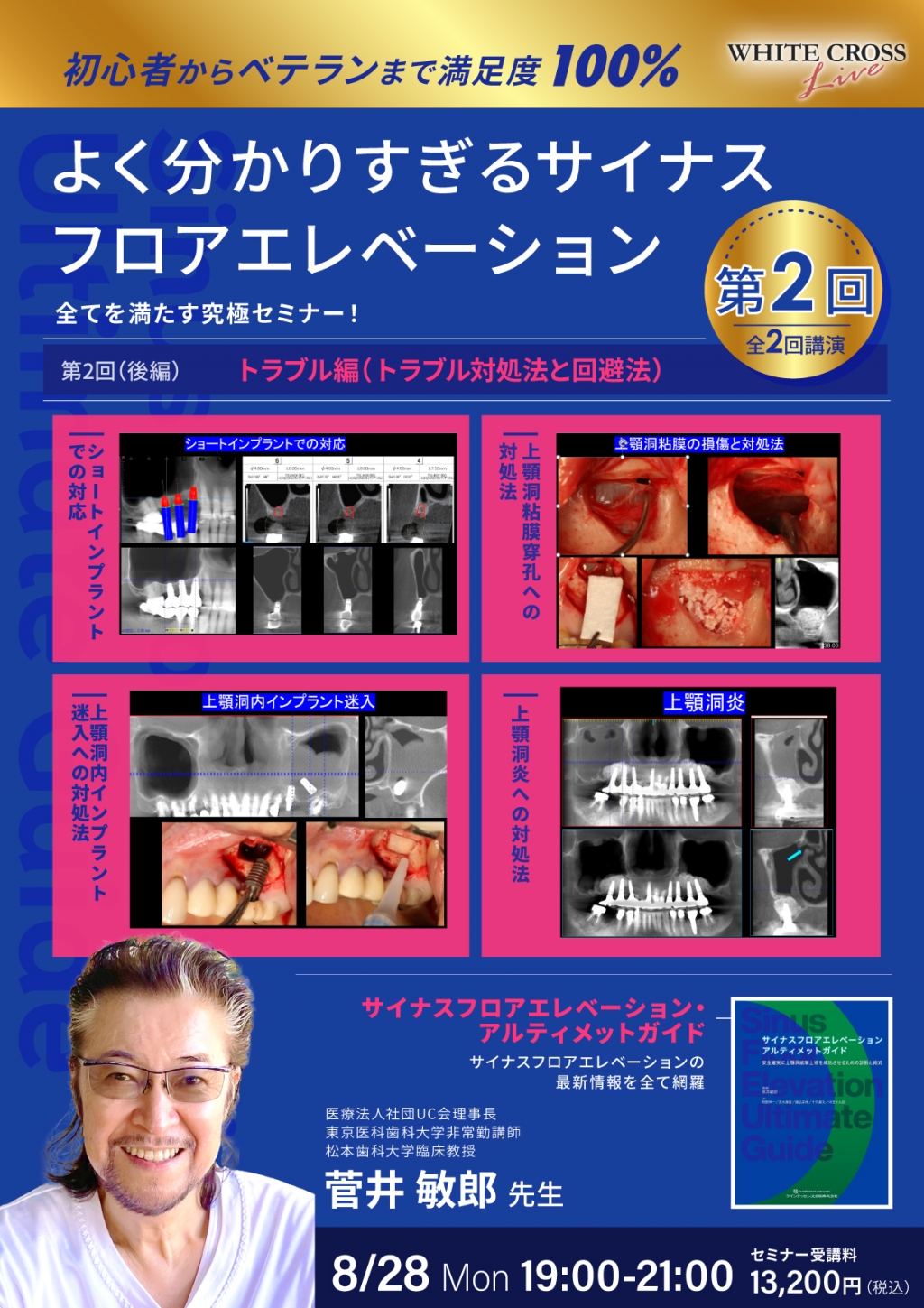 CTと動画が語る サイナスフロアエレベーションの真実 バイオロジーと併発症対策 CTと動画が語る サイナスフロアエレベーションの真実