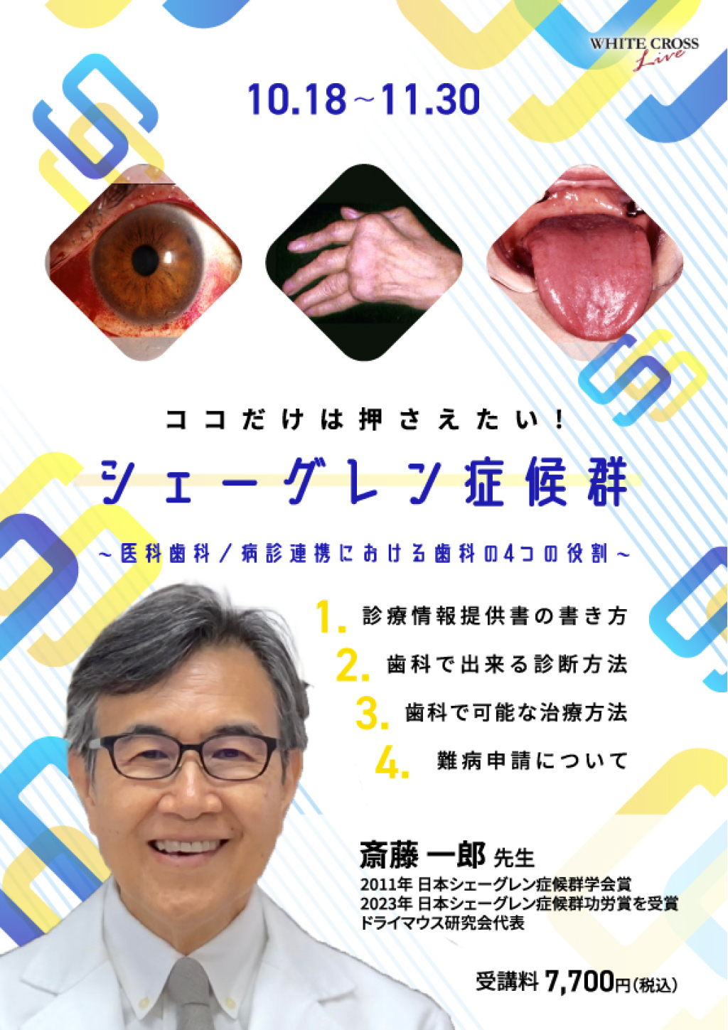 ココだけは押さえたい！シェーグレン症候群～医科歯科／病診連携