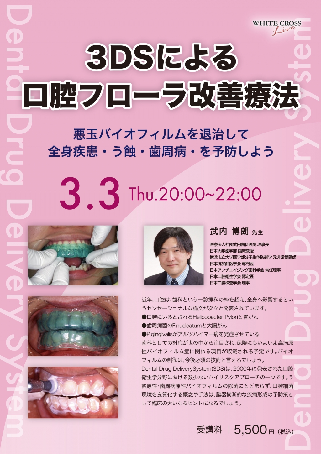 3DSによる口腔フローラ改善療法 3DSによる口腔フローラ改善療法 口腔病原微生物叢の制御技術と疾病