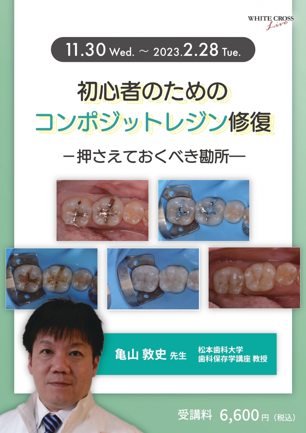 歯科再生・修復医療と材料 DENT.EX systema genki j｜一般のお客さま向け情報｜ライオン