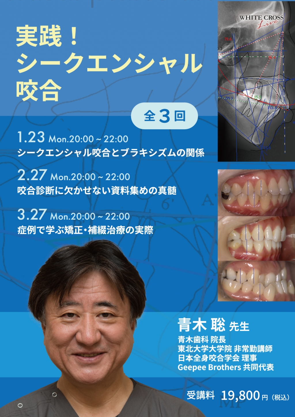 録画配信］全3回 実践！シークエンシャル咬合 | WHITE CROSS