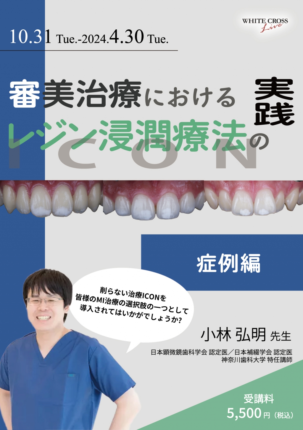 VOD］ 審美治療におけるレジン浸潤療法（ICON）の実践〜症例編